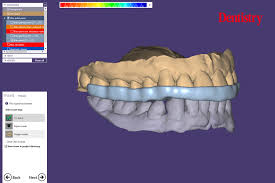 2 hours Personal 1-on-1 Zoom Training – Digital Dentistry Support