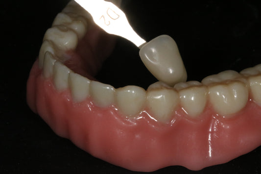 3 hours Personal 1-on-1 Zoom Training – Digital Dentistry Support